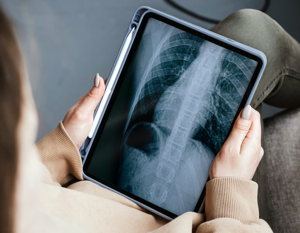 Digital X-Ray Imaging Ojai, CA